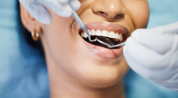 Best Emergency Dental Filling Replacement  in Walton Park, NY